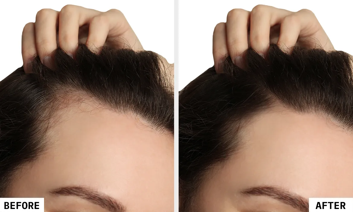 Before_After_01_HB1