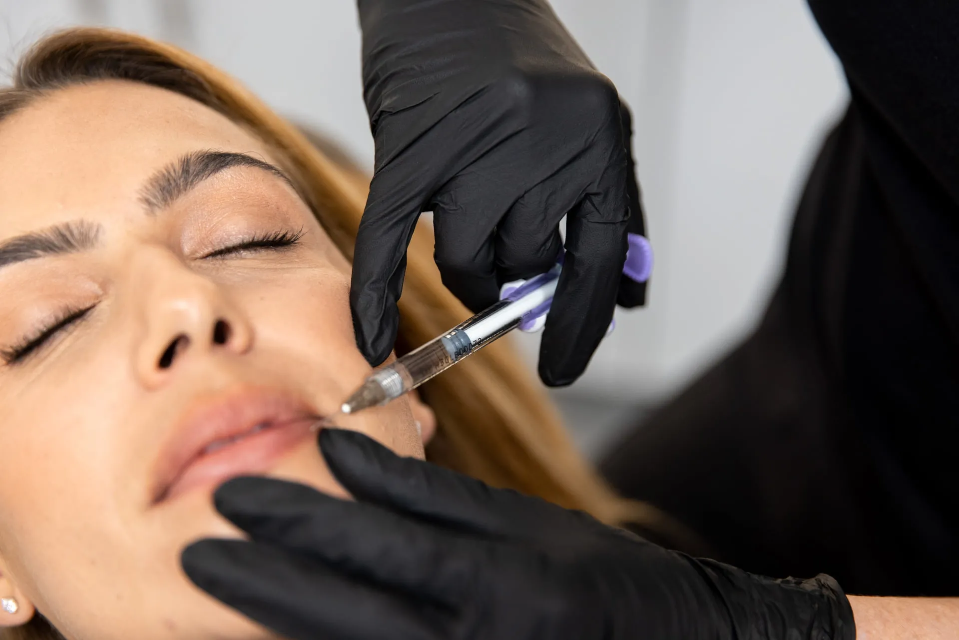 dermal-filler-treatment-img