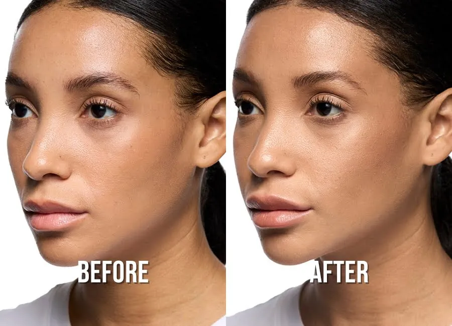 lips-before-after-1-img