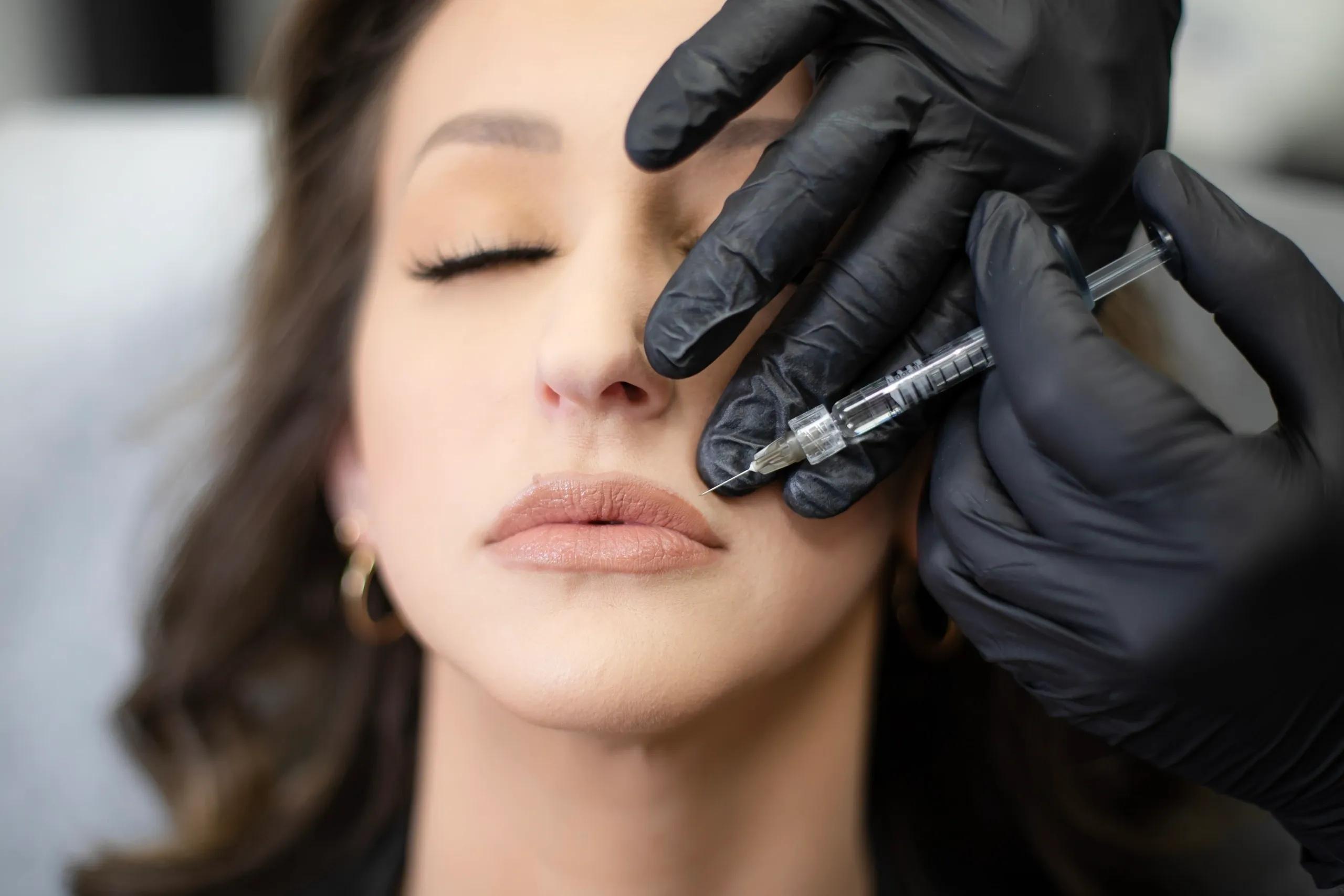 radiesse-dermal-filler-injectable-treatment-buffalo-img